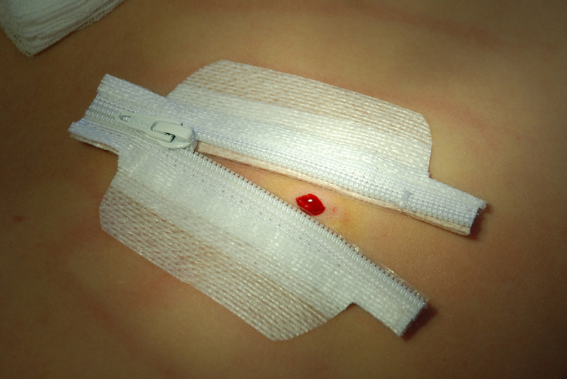 Medizip